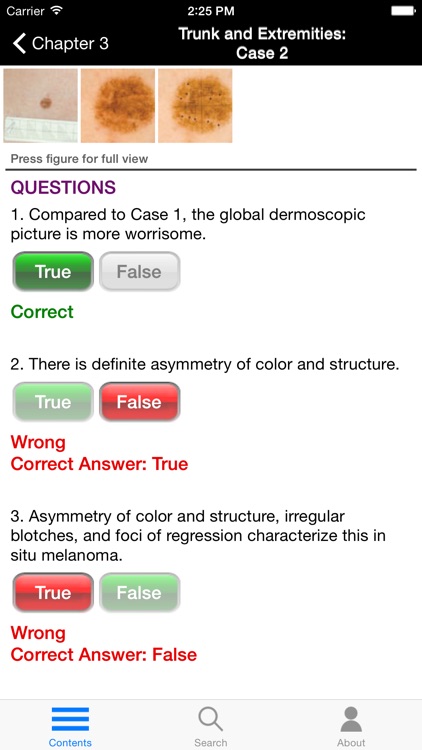 Dermoscopy: An Illustrated Self-Assessment Guide
