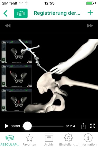 AESCULAP® OrthoPilot® Elite screenshot 2