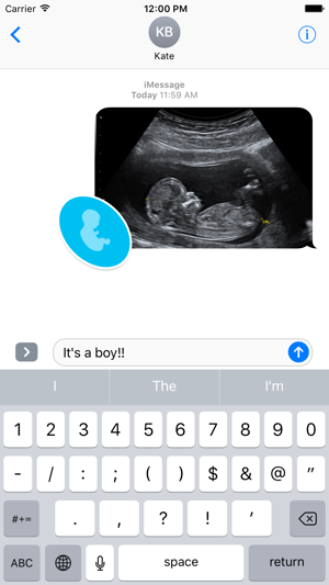 Pregnancy Stickers Pack(圖4)-速報App