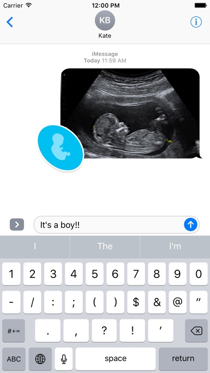 Pregnancy Stickers Pack screenshot-3