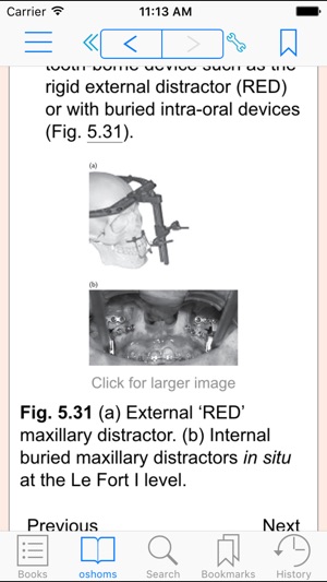 Oral and Maxillofacial Surgery, Second Edition(圖3)-速報App