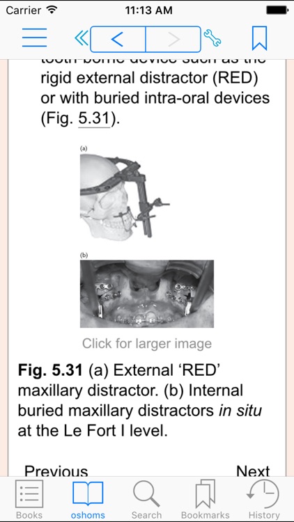 Oral and Maxillofacial Surgery, Second Edition