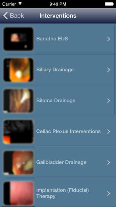 How to cancel & delete EUS - Diagnostic and Interventional Endoscopic Ultrasound from iphone & ipad 3