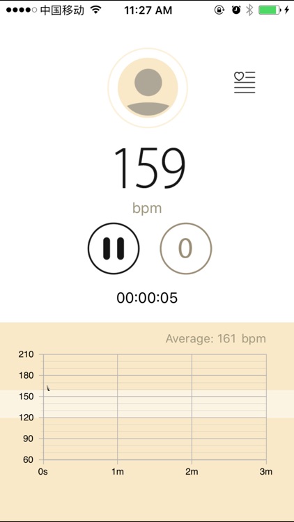 FHR Monitor