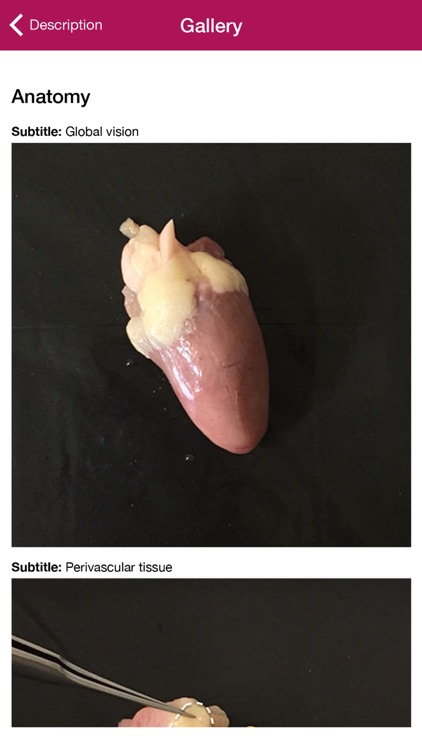 Microsurgery Intuitive screenshot-4