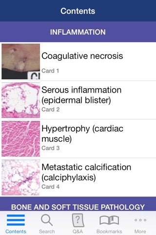 Anatomic Pathology Flashcards screenshot 2