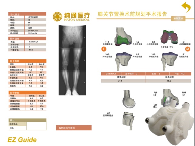 EZ Guide Knee(圖5)-速報App