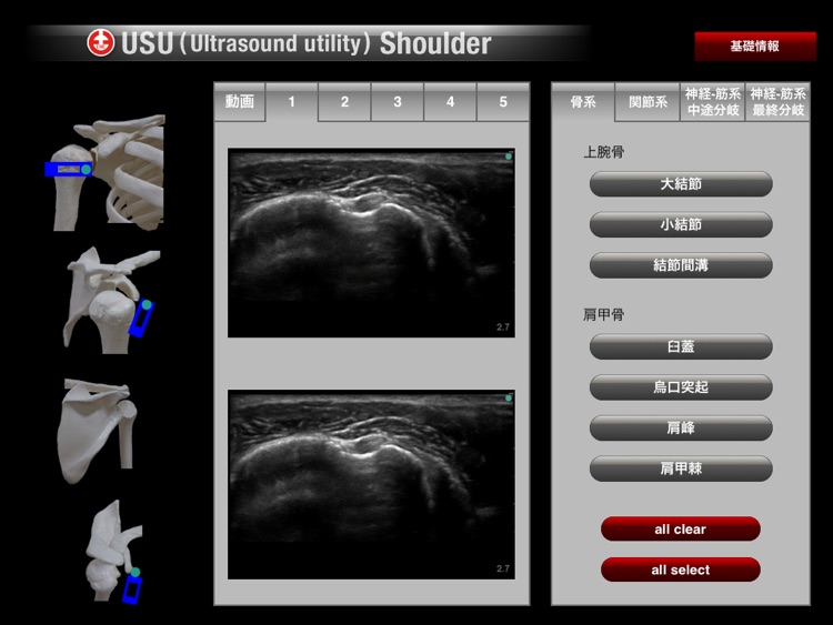 USU Shoulder