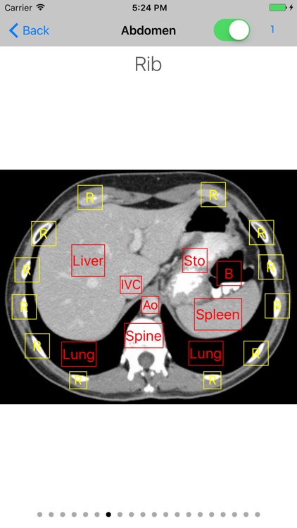 iAnatomy for Patients screenshot-3