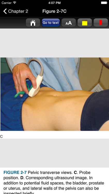 Pocket Atlas of Emergency Ultrasound screenshot-3