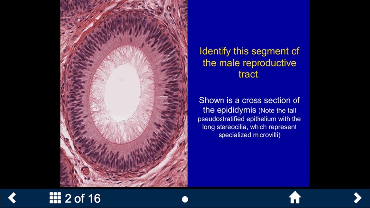 Histology - Urinary-Endocrine-Reproductive Systems screenshot-3