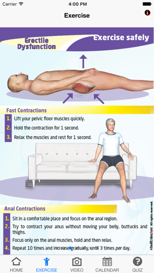 Exercise Erectile Dysfunction(圖2)-速報App