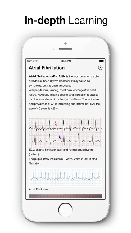 ECG Test Pro - Challenge Your Interpreting Skills screenshot-4