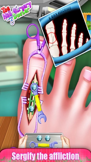 Toe Nail Surgery Doctor - free kids games for fun(圖2)-速報App