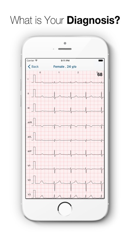ECG Test Pro - Challenge Your Interpreting Skills