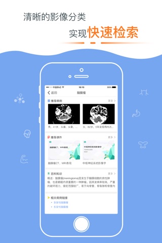 医学影像 screenshot 3