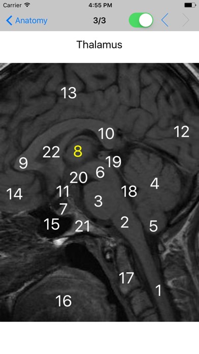 How to cancel & delete Brain Images from iphone & ipad 2