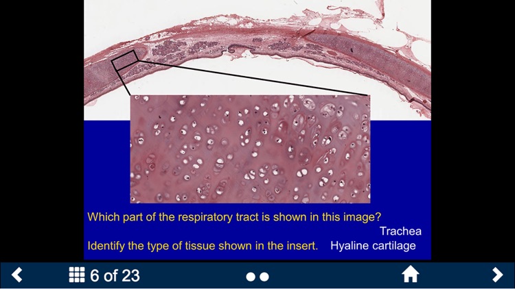 Histology - Cardiovascular and Lymphatic System screenshot-4