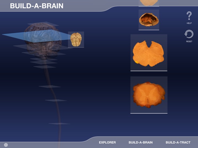 Build-A-Brain Explorer(圖3)-速報App