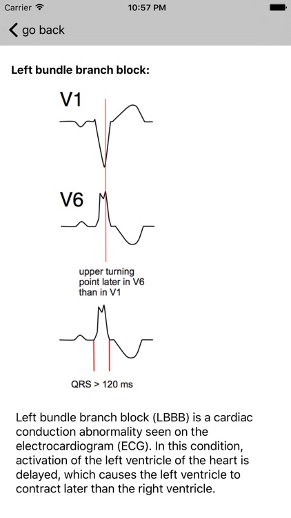 Learn ECG