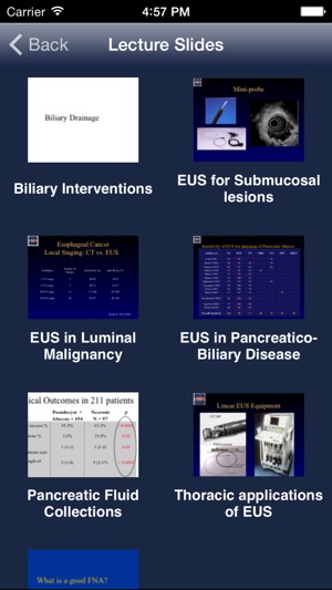 EUS - Diagnostic and Interventional Endoscopic Ultrasound(圖5)-速報App