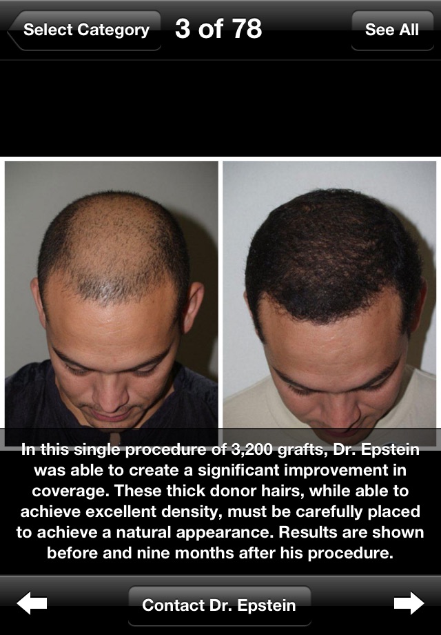 Dr. Epstein - Plastic & Hair Restoration Surgeon screenshot 2