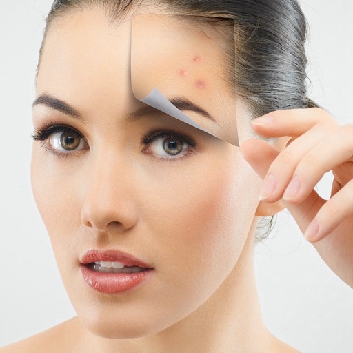 Acne 101-How to Get Rid of Pimples