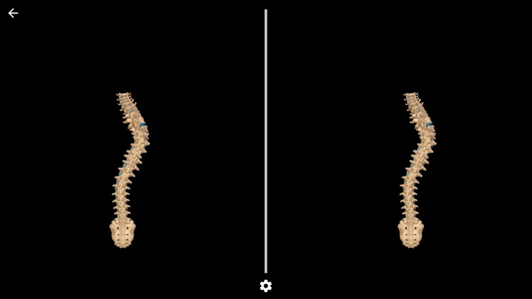 Scoliosis VR