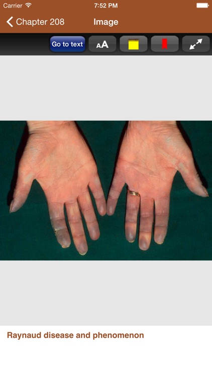 Treatment of Skin Disease, 4/E screenshot-3