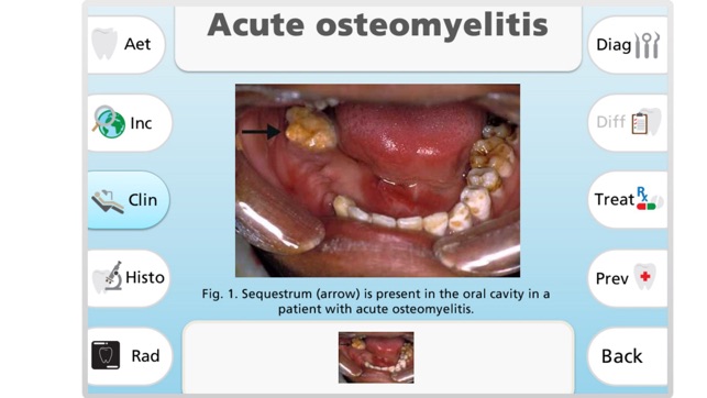 Maxillofacial Pathology(圖2)-速報App