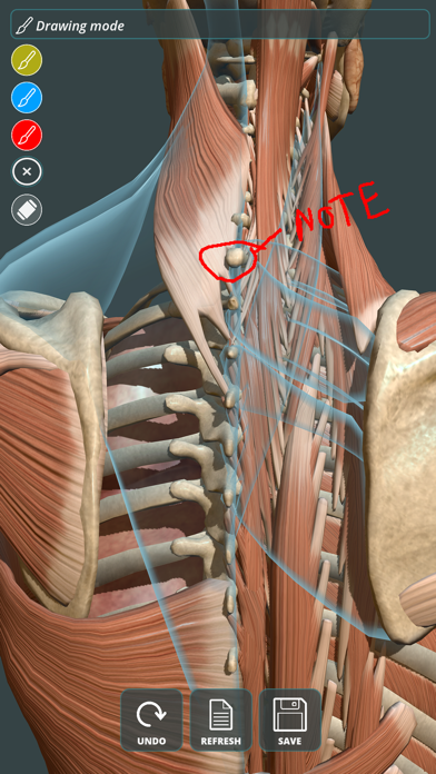 How to cancel & delete Visual Anatomy 3D | Human from iphone & ipad 2