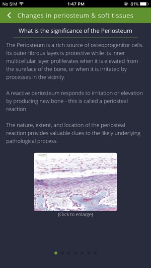 Bone Lesions(圖3)-速報App