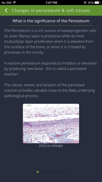 How to cancel & delete Bone Lesions from iphone & ipad 3