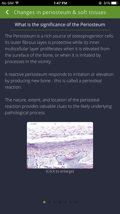 Bone Lesions