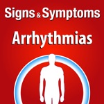 Signs  Symptoms Arrhythmias