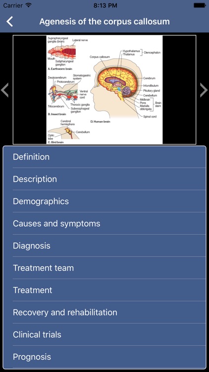 Dictionary of Neurological Disorders for iPhone screenshot-3