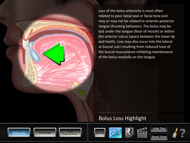 Oral Disorders(圖2)-速報App