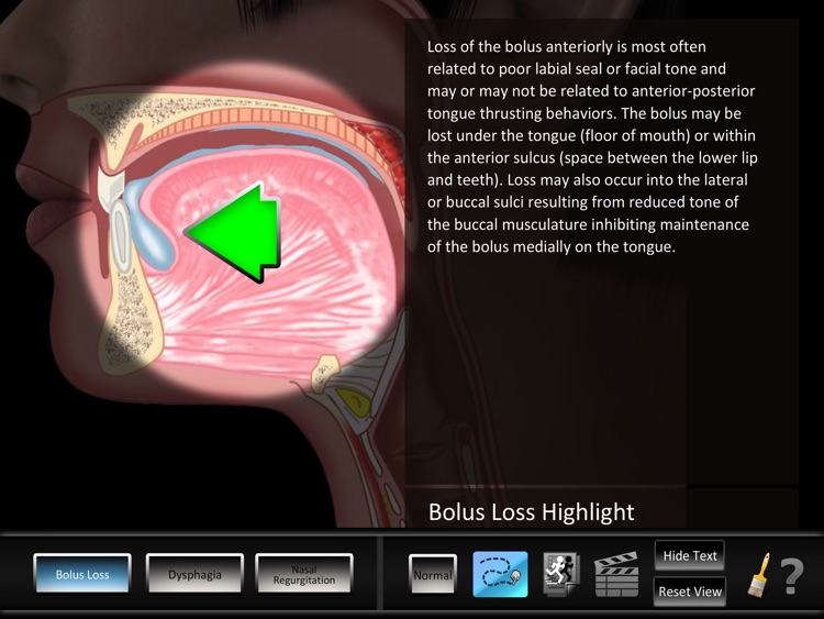 Oral Disorders