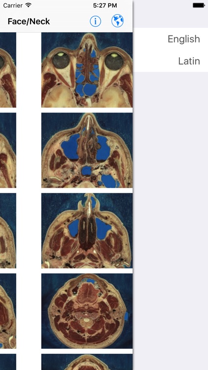 iAnatomy screenshot-3
