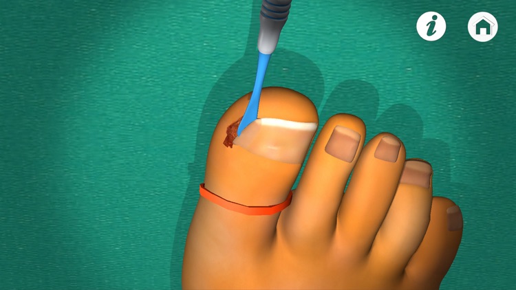 Podiatry 3D (Free Version) screenshot-3