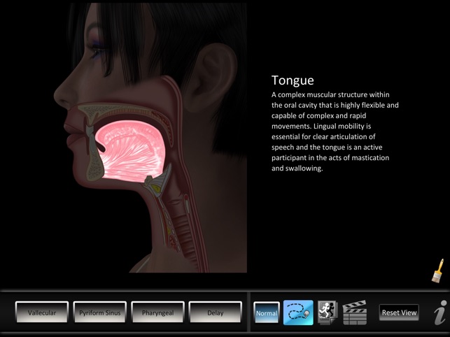 Residue Disorders(圖5)-速報App