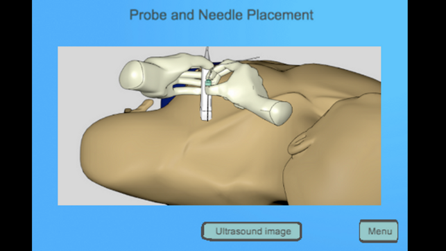 Regional Anesthesia Assistant for iPhone(圖1)-速報App