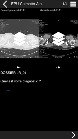 Cours TDM multicoupe du thorax(圖2)-速報App