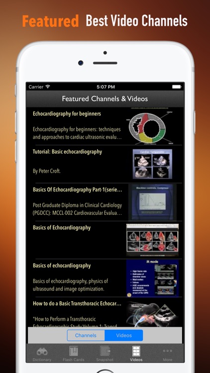 Echocardiography Glossary|Cheatsheet,Study Guide