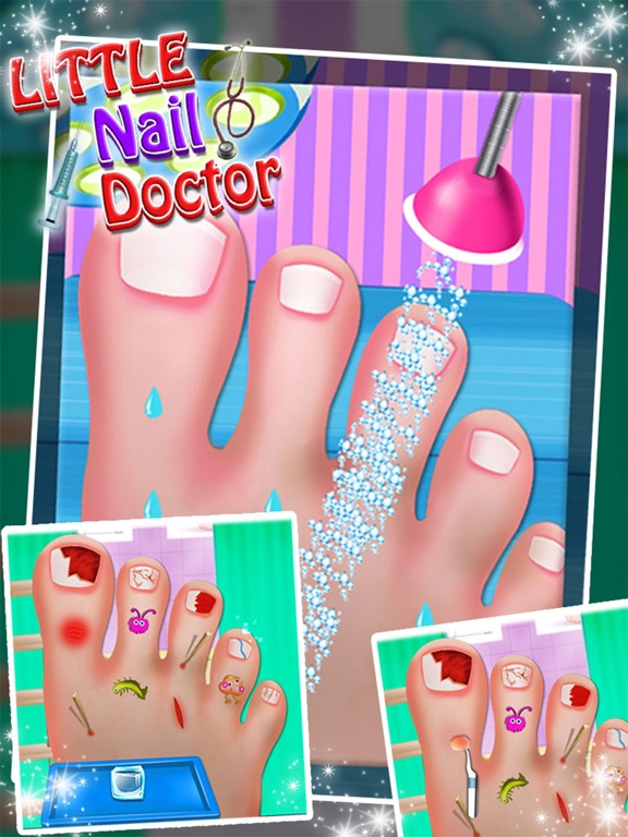 Toe Nail Doctor - Little Nail Surgery kids gamesのおすすめ画像4