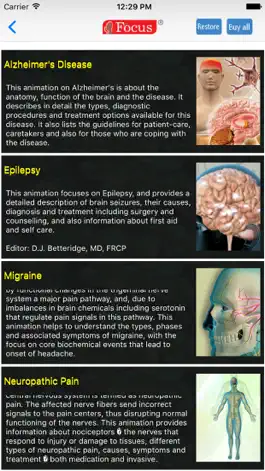 Game screenshot Neurology - Understanding Disease apk