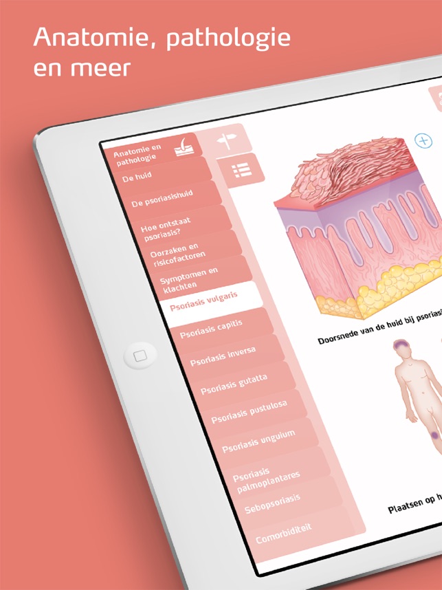 Psoriasis Zorgatlas(圖3)-速報App
