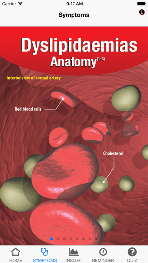 Signs & Symptoms Dyslipidaemias(圖2)-速報App