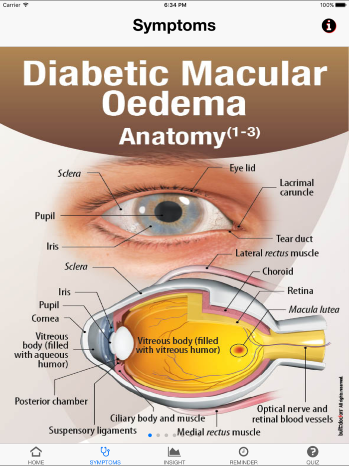 Macula lutea анатомия. Lid терапия.