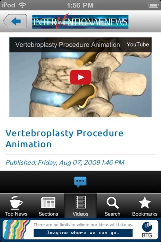 Interventional News screenshot 2